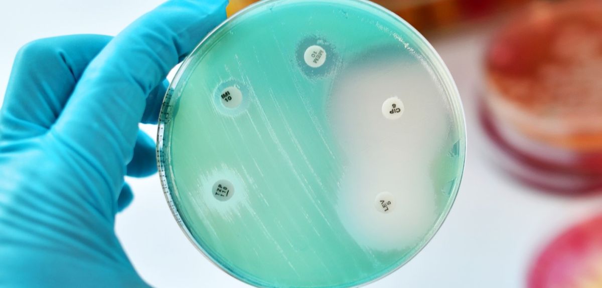 A hand wearing a blue latex glove holds up a petri dish which has colonies of bacteria growing on it. Clear circles can be seen on the plate where an antibiotic has prevented the bacteria from growing. In the background is a stack of petri dishes